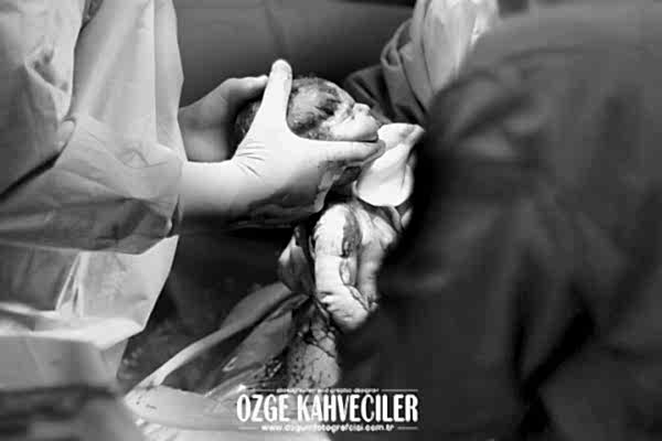 amerikan-hastanesi-dogumfotografcisi copy