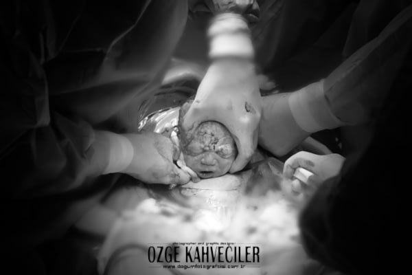 zeytinburnu-dogumfotografcisi copy