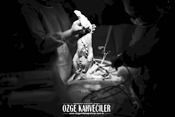 ümraniye-dogumfotografcisi copy