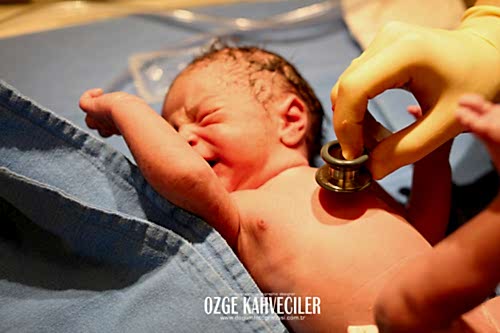 koç üniversitesi hastanesi doğum çekimleri 22