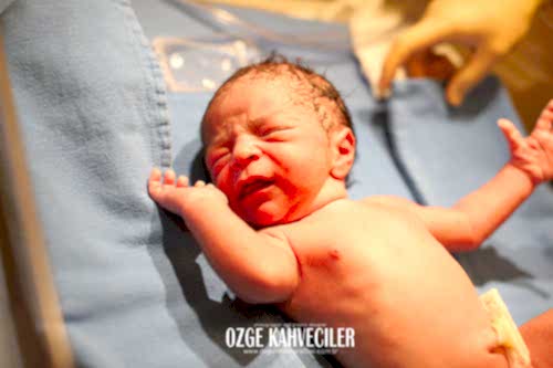 koç üniversitesi hastanesi doğum çekimleri 24